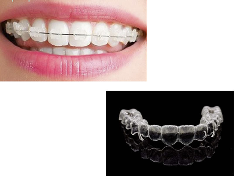 Ortodoncia Correctiva