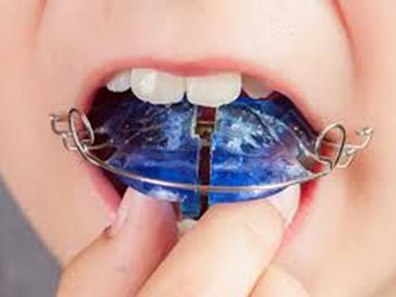 Utilizamos los materiales de m&aacute;s alta calidad